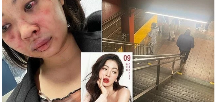 視頻曝光! 23歲亞裔嫩模遭口罩男鎖喉性騷擾 重砸數拳 不成人樣!